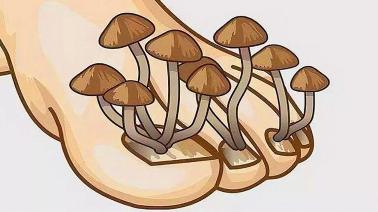 This simple remedy transforms your foot fungus in just one week… find out how!