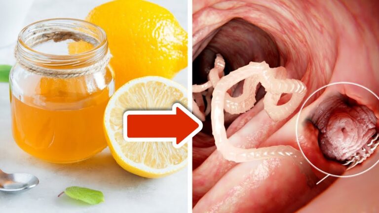 Banish Worms with 1 Simple Trick: Lemon Peel and Honey Combo That Works Every Time!