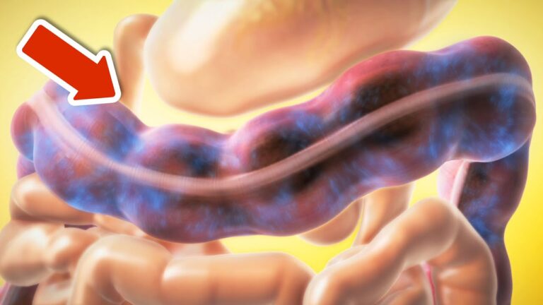 5 Natural Ways to Cleanse Your Stomach and Gut You Need to Know Now!