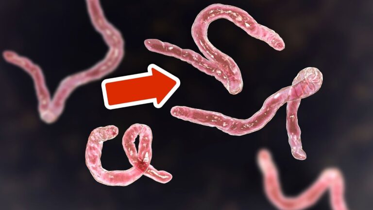 7 Natural Ways to Eliminate Parasites for Good! Discover the Secrets Today!