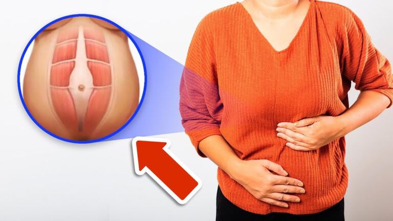 5 Powerful Tips to Stop Upper Abdominal Bloat for Good!