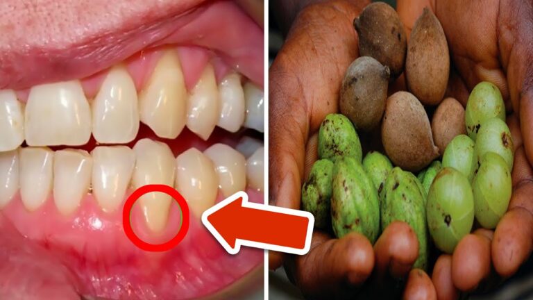 3 Fruits That Can Fix Almost All Tooth and Gum Problems Instantly! Discover How!
