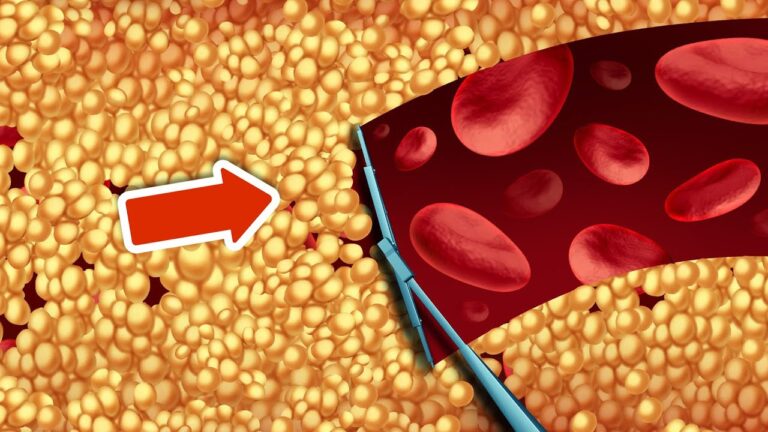 8 Simple Ways to Naturally Lower Your Cholesterol and Feel Great!