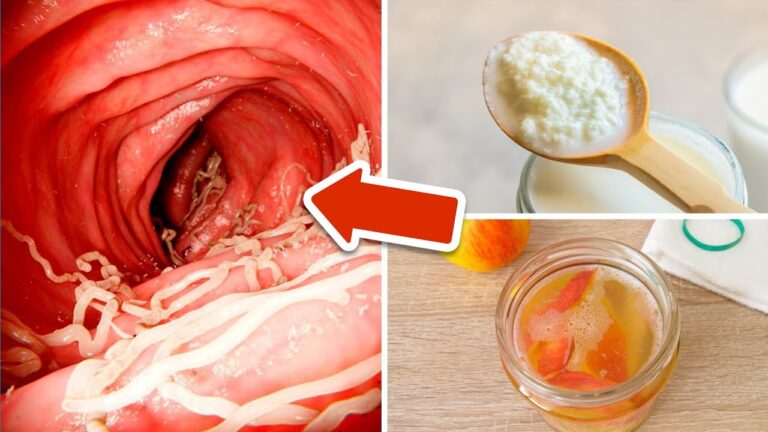 4 Natural Foods to Eliminate Intestinal Worms Easily and Effectively!