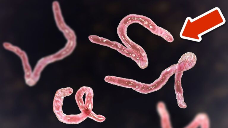 6 Warning Signs You Need a Parasite Cleanse Now! Discover the Truth Behind Your Health.