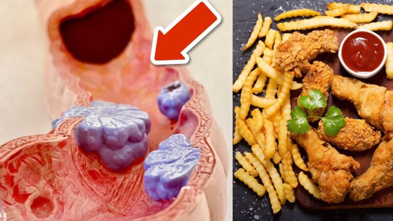 6 Foods You Should NEVER Eat If You Have Colon Cancer – Discover Why!